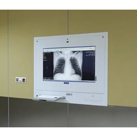 Ultraviol Orvosi képnéző állomás DICO 1M